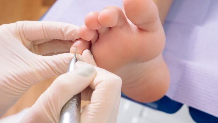 Why Foot Pain Patients Delay Treatment